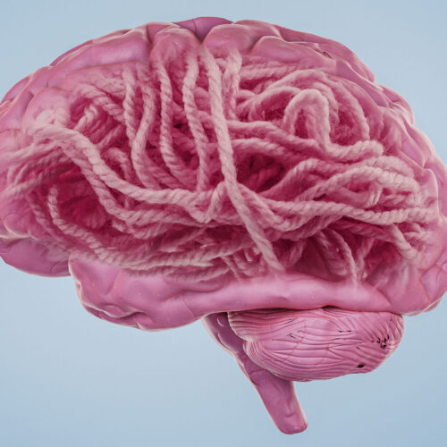 What’s the deal with Alzheimer’s disease and amyloid?