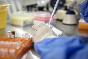 Supercharging Immune Cells May Help Control HIV Long-Term