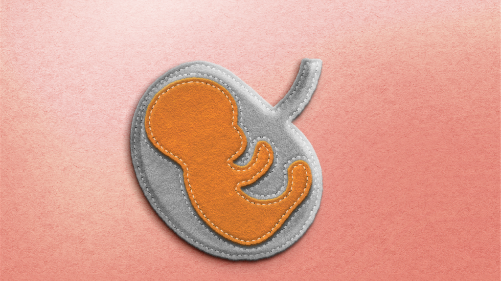 My business is not my baby, and yours shouldn’t be either
