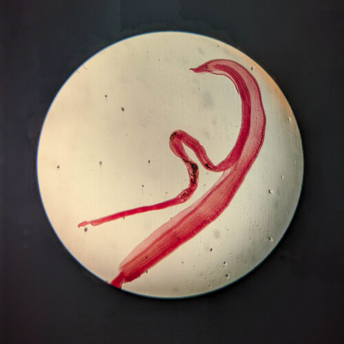 Woman's brain worm infection confirmed after eggs grow tails in lab test