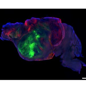 Researchers swap in human brain cells for a mouse's cortex